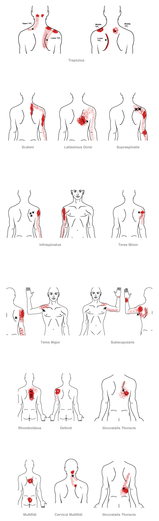 trigger point referral pain pattern for the mid back