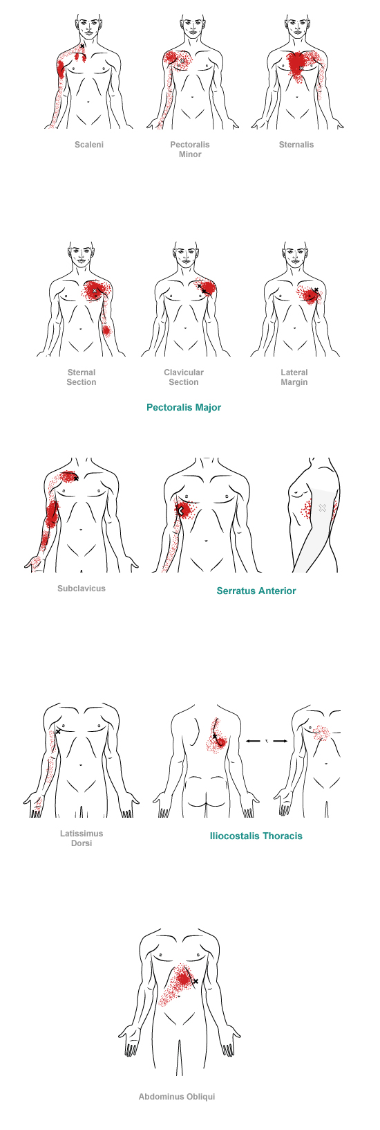 trigger point referral pain pattern for the chest