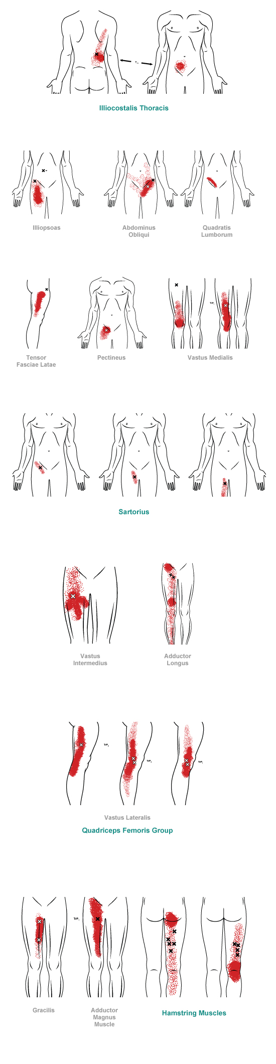 trigger point referral pain pattern for the groin & thigh