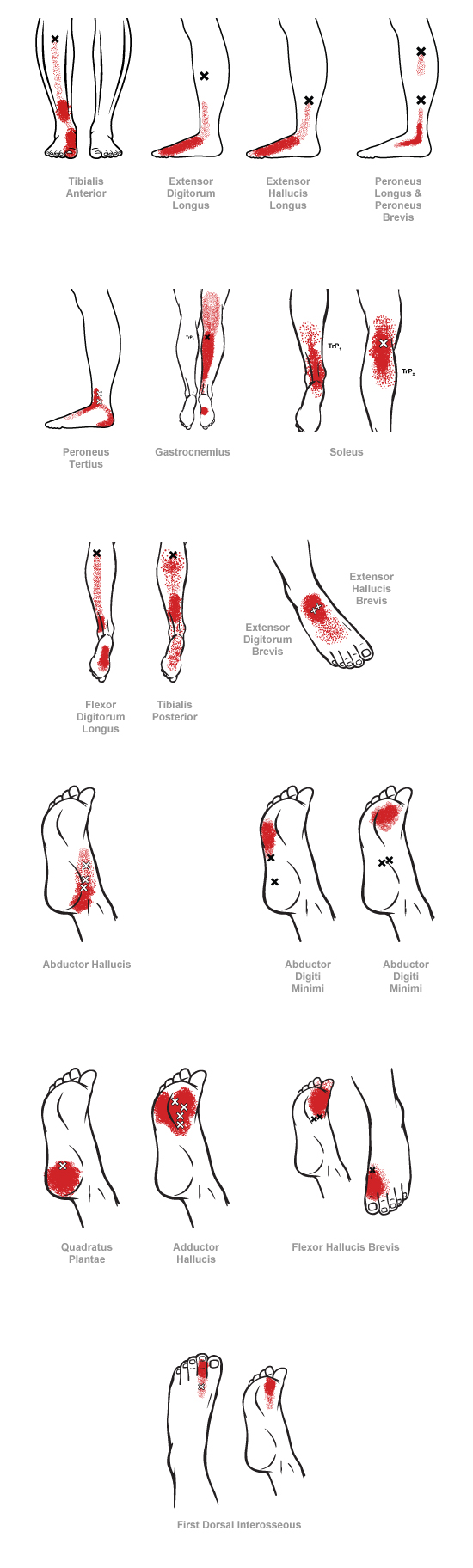 trigger point referral pain patterns for the ankle & foot